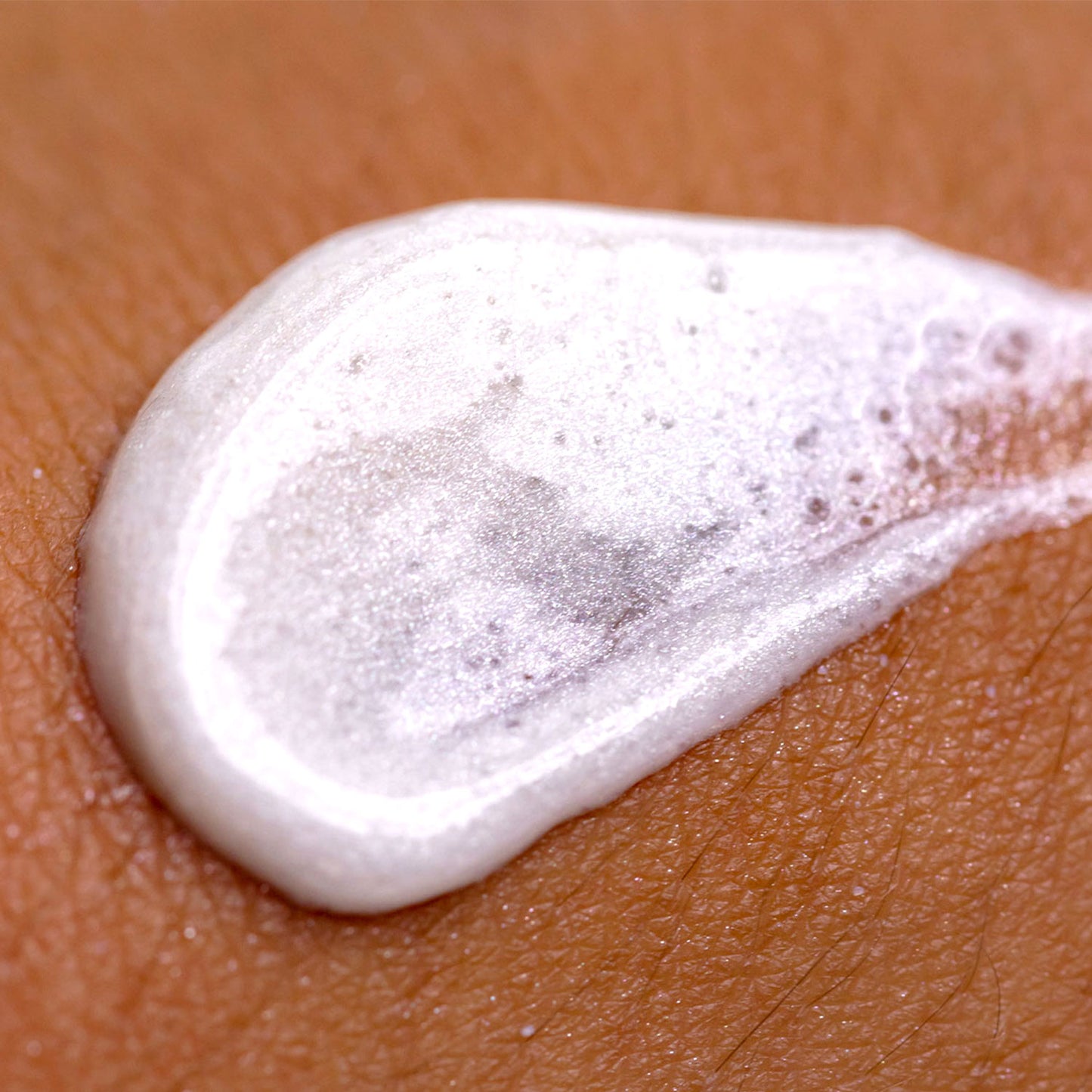 Microdermabrasion
